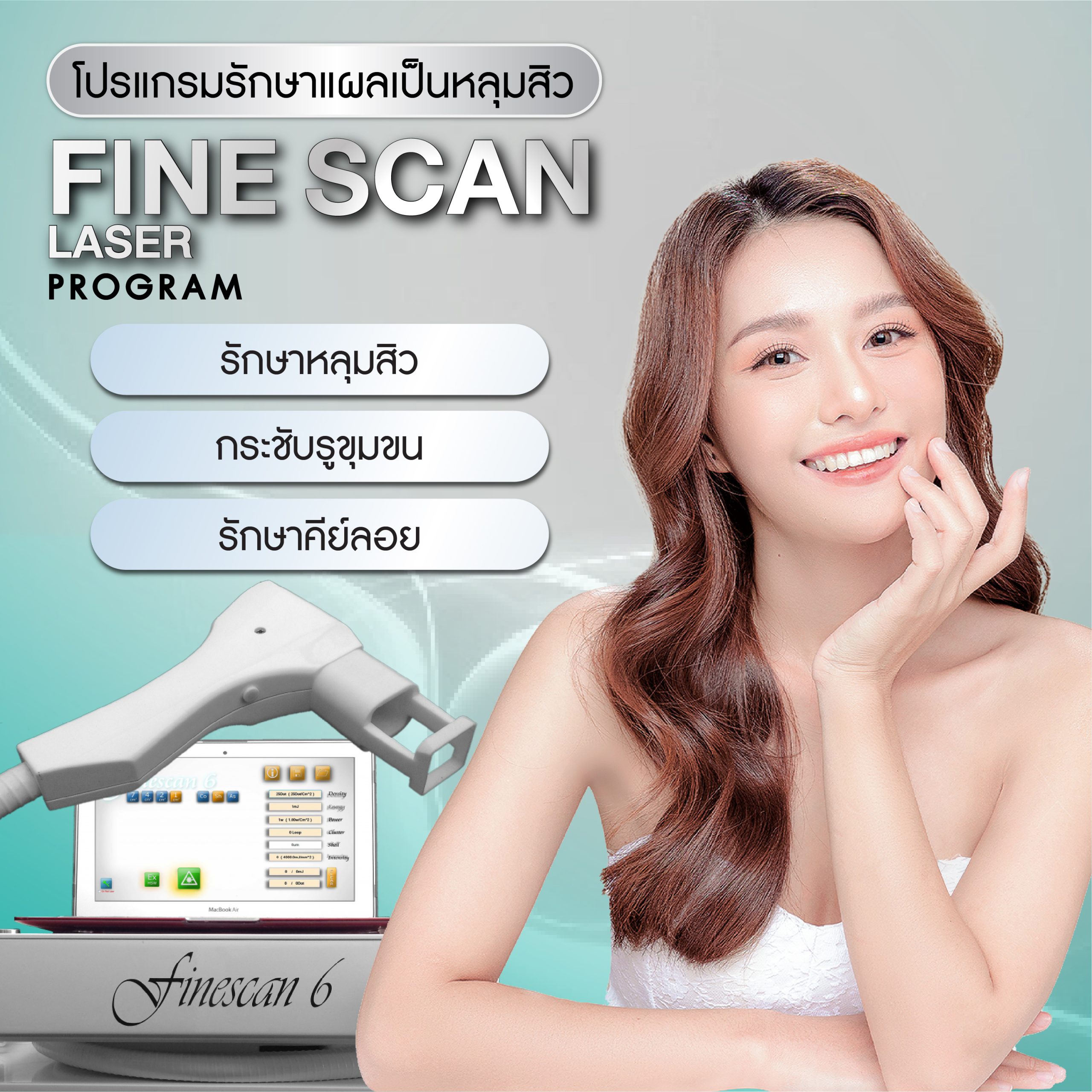 Fine Scan Laser program (โปรแกรม ไฟน์ สแกน เลเซอร์)