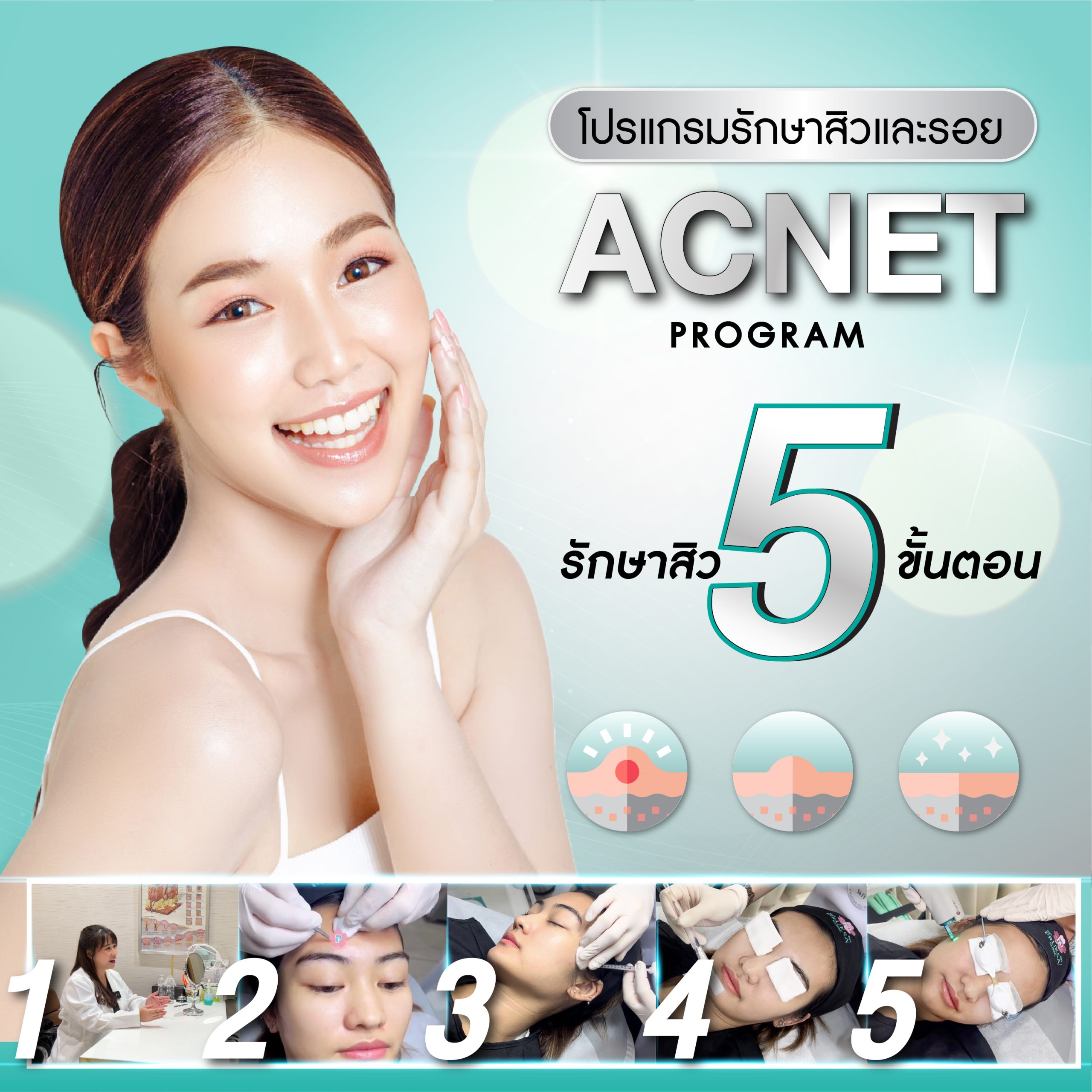 Acnet Program (แอคเนท โปรแกรม)