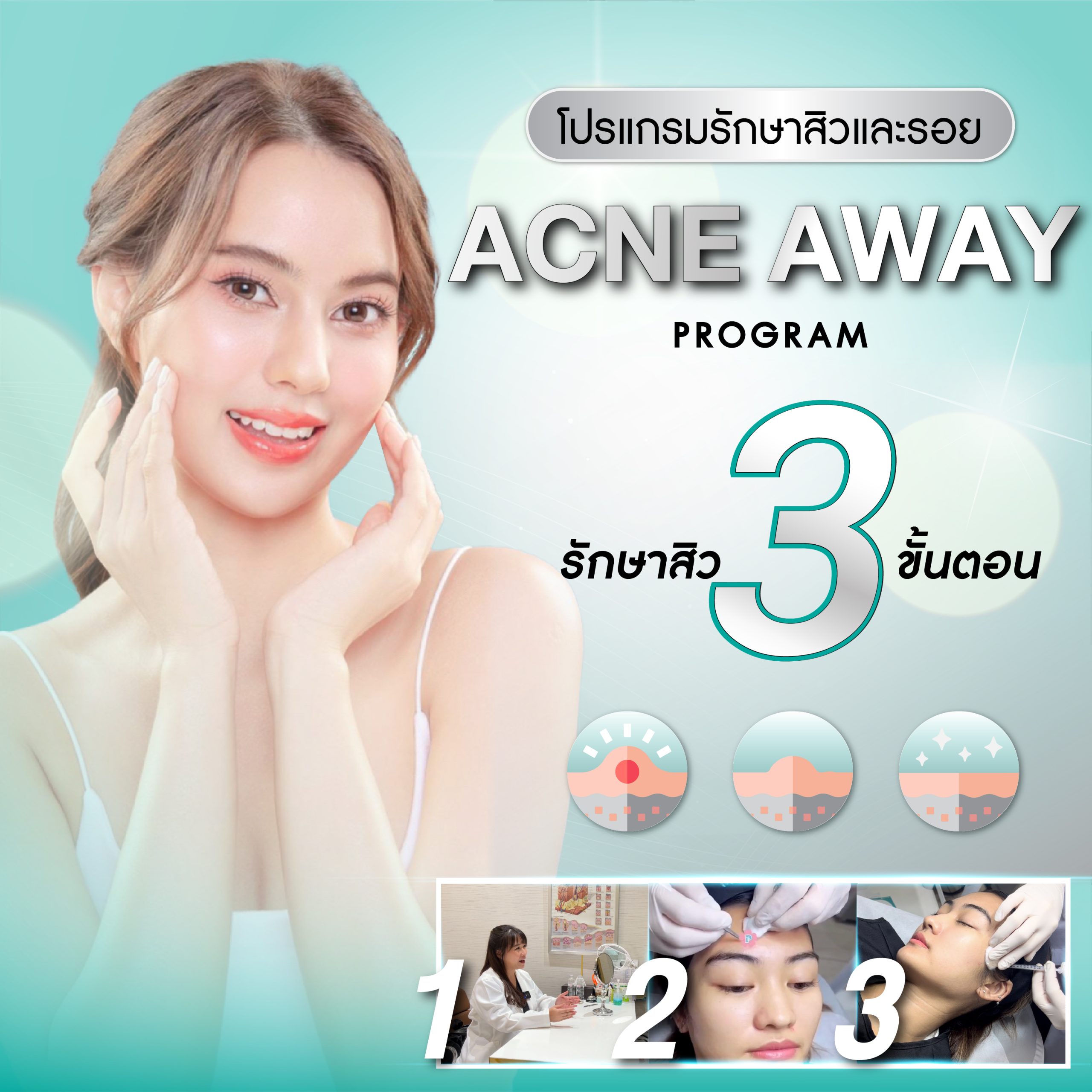 Acne Away program (โปรแกรม แอคเน่ อะเวย์)