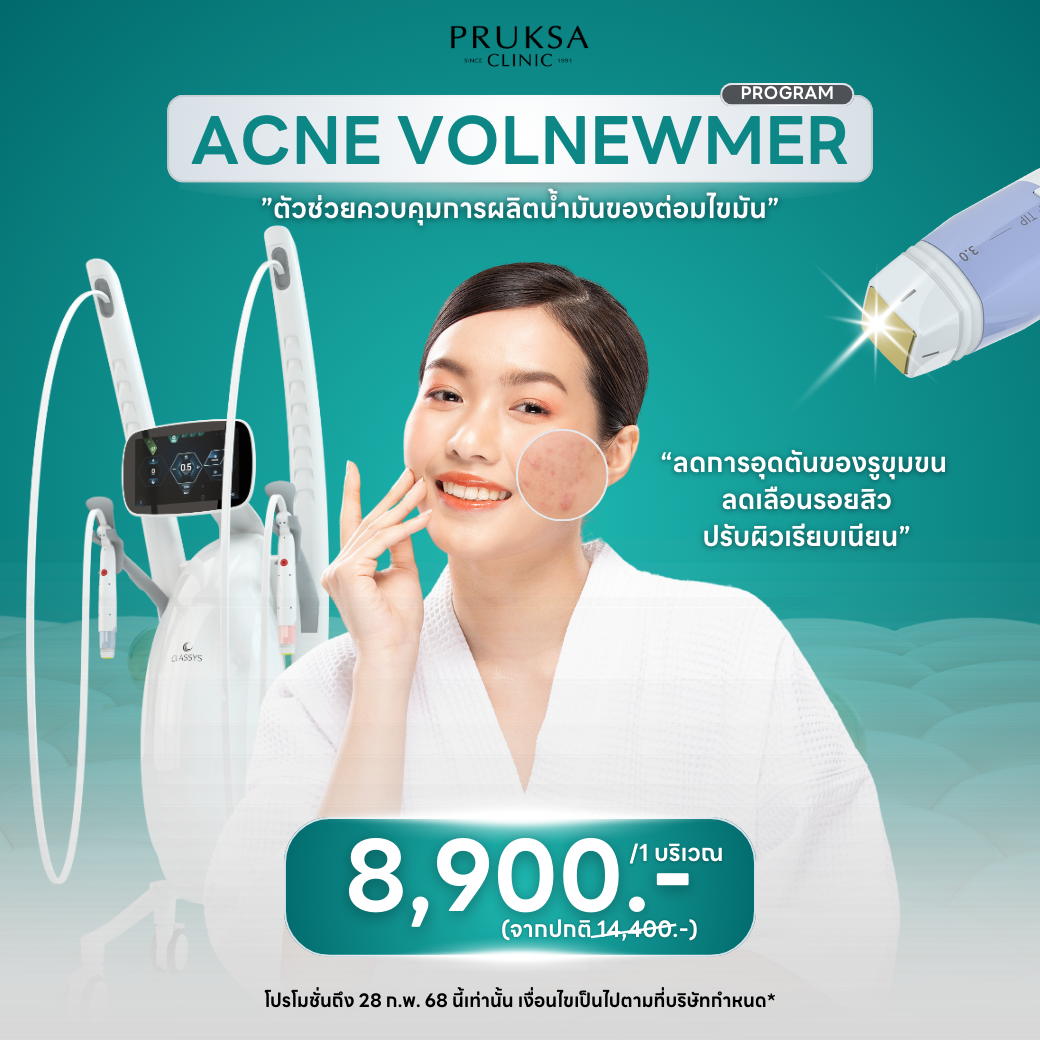 AcneVolnewner Program “ลดการอุดตัน ลดเลือนรอยสิว ปรับผิวเรียบเนียน”